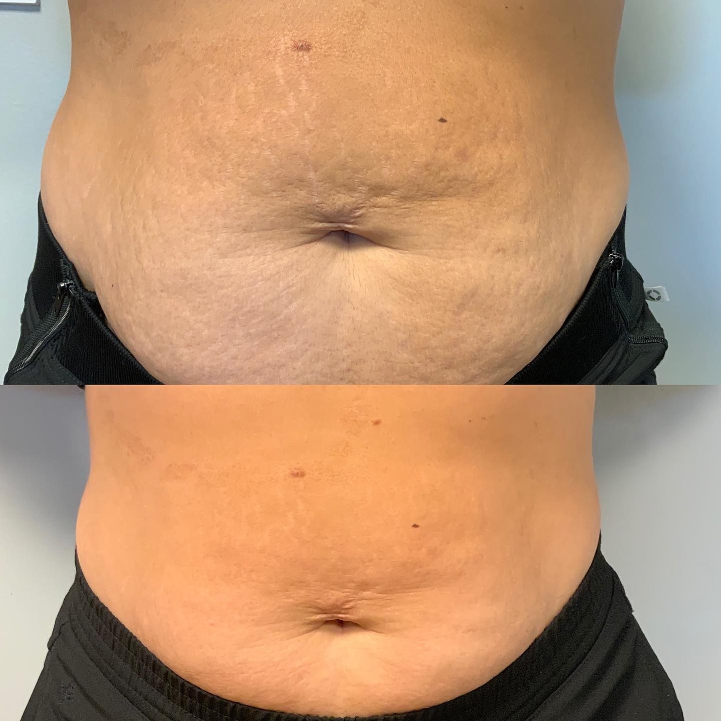 nūda™ 15-Day Cellulite Sculpt & Tighten Cream