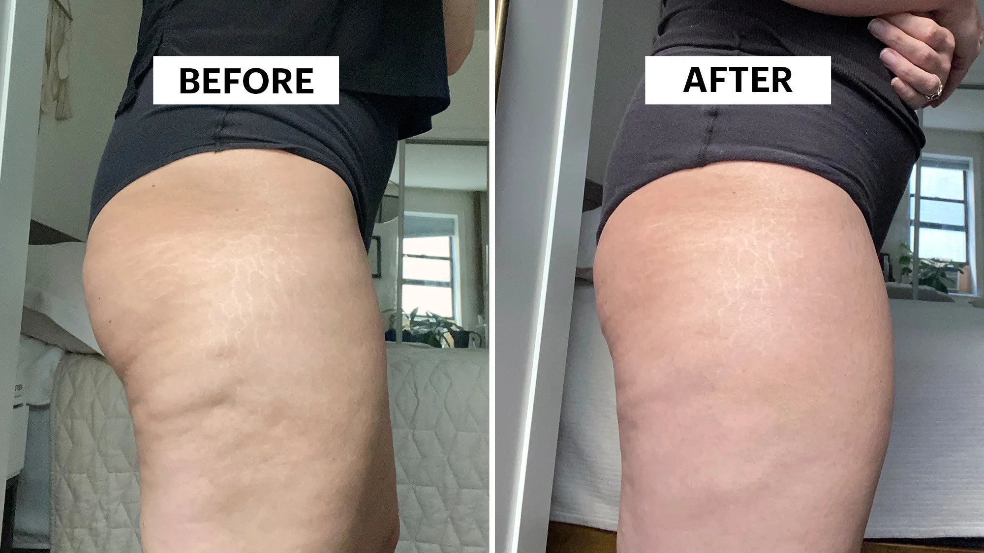 nūda™ 15-Day Cellulite Sculpt & Tighten Cream