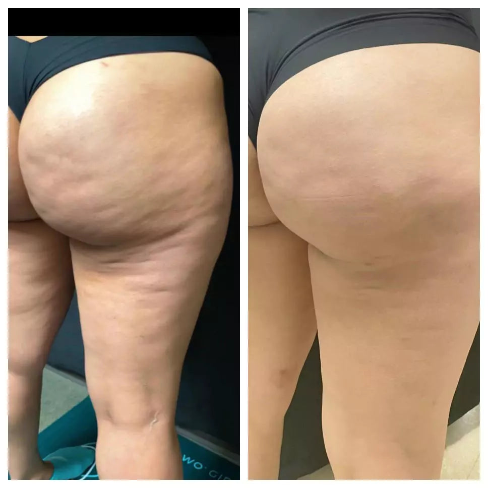 nūda™ 15-Day Cellulite Sculpt & Tighten Cream